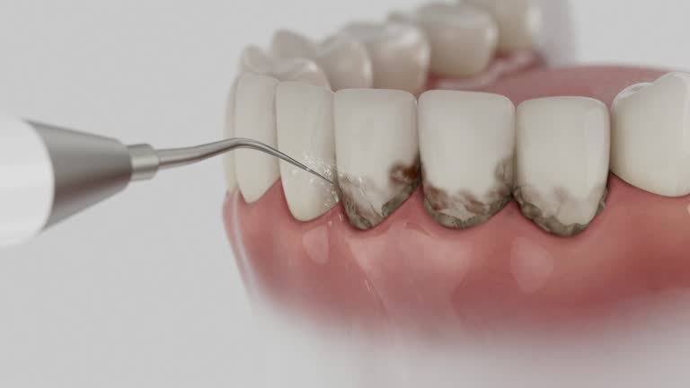 Trusted Dental Implants service in Kermit, TX - Dentist Open Now
